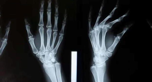 Bone-02